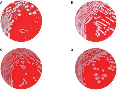 Klebsiella pneumoniae exhibiting a phenotypic hyper-splitting phenomenon including the formation of small colony variants